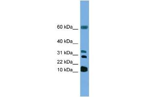 WB Suggested Antibody Titration: 1 ug/ml Positive Control: HepG2 (LTC4S 抗体  (N-Term))