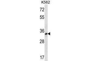 LOC728395 Antibody (C-term) western blot analysis in K562 cell line lysates (35 µg/lane). (TSPY1 抗体  (C-Term))