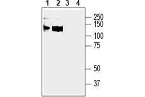 Anoctamin 6 抗体  (2nd Extracellular Loop)