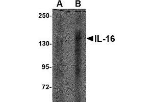 Western Blotting (WB) image for anti-Interleukin 16 (IL16) (N-Term) antibody (ABIN1031693) (IL16 抗体  (N-Term))