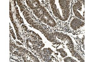 IHC analysis of hnRNP D/AUF1/HNRNPD using anti-hnRNP D/AUF1/HNRNPD antibody (ABIN7602592).