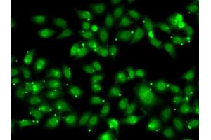 Immunofluorescence analysis of MCF7 cells using NR2C1 antibody (ABIN6128389, ABIN6144809, ABIN6144810 and ABIN6222379).