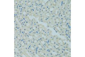 Immunohistochemistry of paraffin-embedded mouse kidney using MBD2 antibody. (MBD2 抗体)