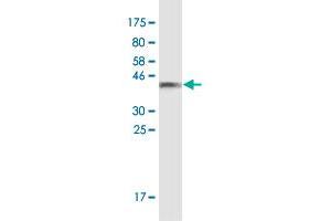 Western Blot detection against Immunogen (35. (TJP3 抗体  (AA 868-952))