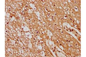 IHC image of ABIN7165614 diluted at 1:400 and staining in paraffin-embedded human brain tissue performed on a Leica BondTM system. (GPR17 抗体  (AA 151-262))