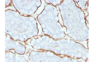 Formalin-fixed, paraffin-embedded human small intestine stained with ACE / CD143 Mouse Monoclonal Antibody (9B9). (Angiotensin I Converting Enzyme 1 抗体)