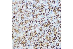 Immunohistochemistry of paraffin-embedded rat ovary using RSPO1 Rabbit pAb (ABIN6132958, ABIN6147279, ABIN6147280 and ABIN6224304) at dilution of 1:100 (40x lens). (RSPO1 抗体  (AA 21-263))