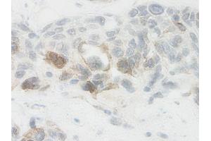 Image no. 2 for anti-Nephroblastoma Overexpressed (NOV) antibody (ABIN465355) (NOV 抗体)