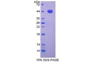 SDS-PAGE analysis of Mouse Noggin Protein. (NOG 蛋白)