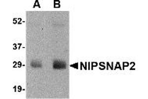 Western Blotting (WB) image for anti-Glioblastoma Amplified Sequence (GBAS) (N-Term) antibody (ABIN1031480) (GBAS 抗体  (N-Term))
