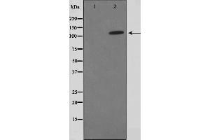 Western blot analysis on HuvEc cell lysate using FIR Antibody,The lane on the left is treated with the antigen-specific peptide.