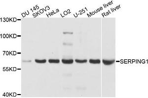 Western blot analysis of extracts of various cells, using SERPING1 antibody. (SERPING1 抗体)