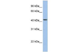 WB Suggested Anti-ZNF202 Antibody Titration:  0.