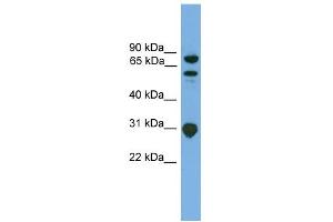 WB Suggested Anti-SH3KBP1 Antibody Titration: 0. (SH3KBP1 抗体  (N-Term))