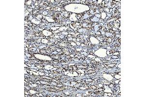 IHC analysis of SF3A3 using anti-SF3A3 antibody (ABIN7599863).