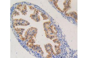 Immunohistochemistry (IHC) image for anti-Polycystic Kidney Disease 2 (Autosomal Dominant) (PKD2) (AA 327-539) antibody (ABIN5014178)