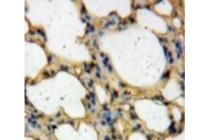 IHC-P analysis of Lung tissue, with DAB staining. (TICAM2 抗体  (AA 34-241))