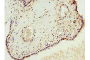 Immunohistochemistry of paraffin-embedded human placenta tissue using ABIN7175638 at dilution of 1:100 (VHLL 抗体  (AA 1-139))