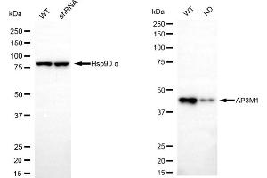 Western blotting analysis using AP3M1 antibody (ABIN7797512). (Recombinant AP3M1 抗体)