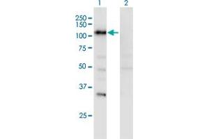 Western Blot analysis of SECISBP2 expression in transfected 293T cell line by SECISBP2 monoclonal antibody (M08), clone 3A7. (SECISBP2 抗体  (AA 106-205))