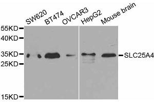 Western blot analysis of extracts of various cell lines, using SLC25A4 antibody. (SLC25A4 抗体  (AA 40-298))