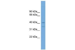 WB Suggested Anti-Foxq1 Antibody Titration:  0. (FOXQ1 抗体  (Middle Region))