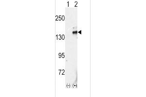 Western blot analysis of RET (arrow) using rabbit polyclonal RET Antibody (C-term ) (ABIN392041 and ABIN2841809).