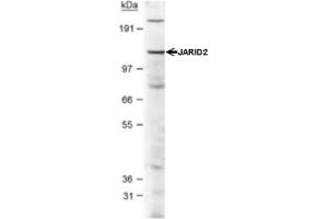 Western Blotting (WB) image for anti-Jumonji, AT Rich Interactive Domain 2 (JARID2) (AA 1-100), (N-Term) antibody (ABIN1951845) (JARID2 抗体  (N-Term))