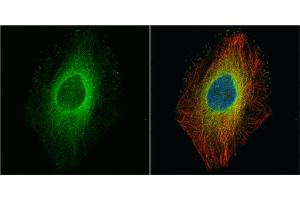 ICC/IF Image ROCK1 antibody [N1N2], N-term detects ROCK1 protein at cytoplasm by immunofluorescent analysis.