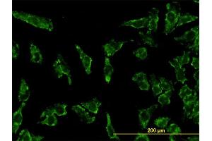 Immunofluorescence (IF) image for anti-Signal Transducer and Activator of Transcription 3 (Acute-Phase Response Factor) (STAT3) (AA 670-769) antibody (ABIN563028)
