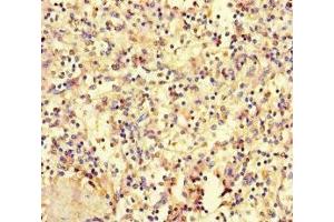 Immunohistochemistry of paraffin-embedded human spleen tissue using ABIN7155778 at dilution of 1:100 (HOXD9 抗体  (AA 38-276))