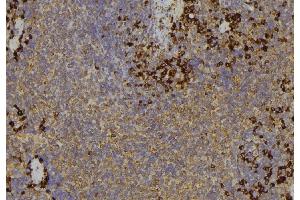 ABIN6279565 at 1/100 staining Human lymph node tissue by IHC-P. (MYO5C 抗体)