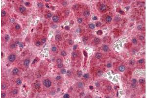 Liver, Human: Formalin-Fixed, Paraffin-Embedded (FFPE) (TIMP2 抗体)