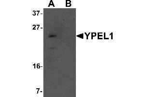 Western blot analysis of YPEL1 in Hela cell lysate with YPEL1 antibody at 1 µg/mL in (A) the absence and (B) the presence of blocking peptide. (YPEL1 抗体  (N-Term))
