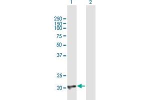 Western Blot analysis of CBFB expression in transfected 293T cell line by CBFB MaxPab polyclonal antibody.
