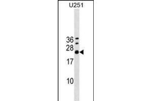 EXOSC4 Antibody (Center) (ABIN1538571 and ABIN2848888) western blot analysis in  cell line lysates (35 μg/lane). (EXOSC4 抗体  (AA 69-96))