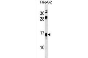 Western Blotting (WB) image for anti-Resistin Like beta (RETNLB) antibody (ABIN3000751) (RETNLB 抗体)