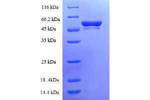 SDS-PAGE (SDS) image for Tryptase beta 2 (TPSB2) (AA 32-276) protein (GST tag) (ABIN5710540)