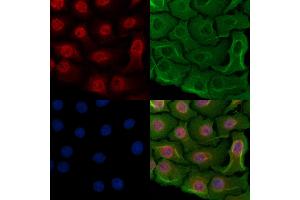 ABIN6257370 and ABIN6274380 staining Hela cells by IF/ICC.