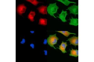 ABIN7094989 and ABIN7099045 staining  cells by IF/ICC. (RRBP1 抗体)