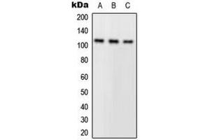 Western blot analysis of PLA2G4A expression in A549 (A), HeLa (B), mouse kidney (C) whole cell lysates. (PLA2G4A 抗体  (N-Term))
