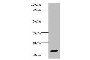 Western blot All lanes: IFNA4 antibody at 2 μg/mL + Mouse kidney tissue Secondary Goat polyclonal to rabbit IgG at 1/10000 dilution Predicted band size: 22 kDa Observed band size: 22 kDa (IFNA4 抗体  (AA 24-189))