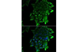 Immunofluorescence analysis of U2OS cells using SEPSECS antibody (ABIN6131515, ABIN6147545, ABIN6147546 and ABIN6222910). (SEPSECS 抗体  (AA 222-501))