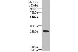 Western blot All lanes: YIPF5 antibody at 5 μg/mL + Mouse liver tissue Secondary Goat polyclonal to rabbit IgG at 1/10000 dilution Predicted band size: 28, 22, 30 kDa Observed band size: 28 kDa (YIPF5 抗体  (AA 1-124))
