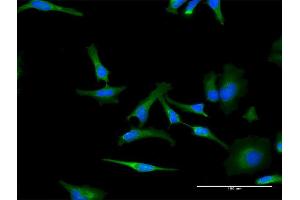 Immunofluorescence of monoclonal antibody to PHB on HeLa cell. (Prohibitin 抗体  (AA 1-272))