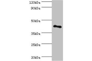 Western blot All lanes: RSAD2 antibody at 8 μg/mL + Jurkat whole cell lysate Secondary Goat polyclonal to rabbit IgG at 1/10000 dilution Predicted band size: 42 kDa Observed band size: 42 kDa (RSAD2 抗体  (AA 42-361))