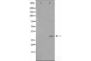 Western blot analysis of Hepg2 whole cell lysates, using PNMT Antibody. (PNMT 抗体  (N-Term))