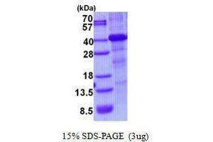 Figure annotation denotes ug of protein loaded and % gel used. (HFE 蛋白)