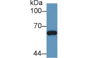 Western blot analysis of Human Hela cell lysate, using Rabbit Anti-Cow Smad1 Antibody (1 µg/ml) and HRP-conjugated Goat Anti-Rabbit antibody (abx400043, 0. (SMAD1 抗体  (AA 270-465))