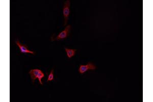 ABIN6269225 staining A-431 cells by IF/ICC. (alpha Adducin 抗体)